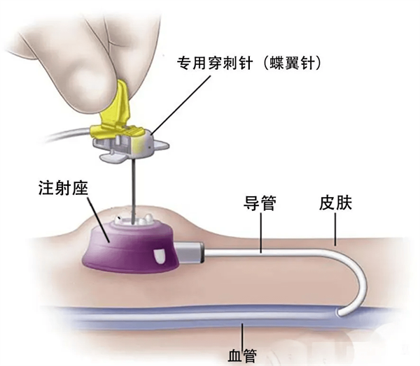 微信图片_20220903082834.png