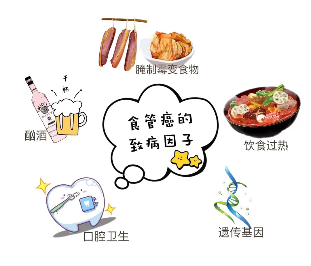 4食道癌.png